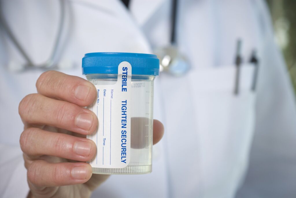 Do health insurance companies drug test?