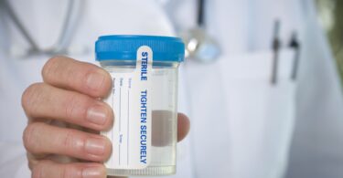 Do health insurance companies drug test?